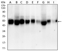 1 - Anti-ALDH2 Antibody AP95661