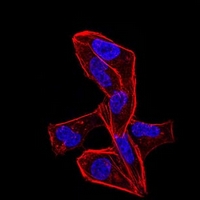 3 - Anti-ALDH6A1 Antibody AP95662