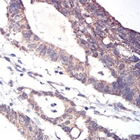 19 - Anti-ALDH6A1 Antibody AP95662