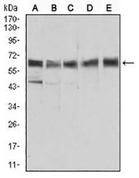 1 - Anti-ALDH6A1 Antibody AP95662
