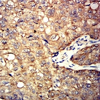 19 - Anti-ALDOA Antibody AP95663