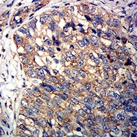 19 - Anti-CD246 Antibody AP95664