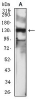 1 - Anti-CD246 Antibody AP95664