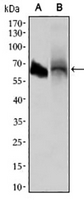 1 - Anti-ALPI Antibody AP95665