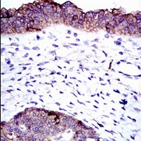 19 - Anti-ALPL Antibody AP95666