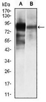 1 - Anti-ALPL Antibody AP95666