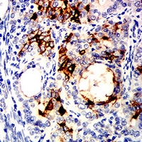 19 - Anti-ALPPL2 Antibody AP95667