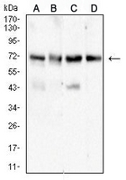 1 - Anti-ALPPL2 Antibody AP95667