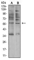 1 - Anti-AMY1A Antibody AP95668