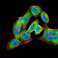 3 - Anti-Annexin A5 Antibody AP95670
