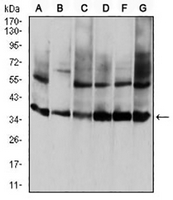 1 - Anti-Annexin A5 Antibody AP95670
