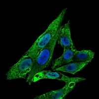 3 - Anti-RhoGDI alpha Antibody AP95673