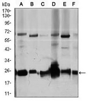 1 - Anti-RhoGDI alpha Antibody AP95673