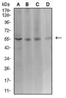 1 - Anti-ASF1B Antibody AP95674