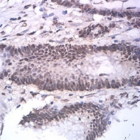 19 - Anti-ASH2L Antibody AP95675