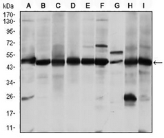 1 - Anti-ASS1 Antibody AP95676