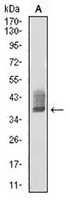 1 - Anti-ATG10 Antibody AP95677