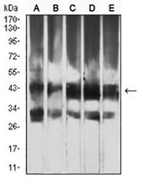 1 - Anti-ATG4B Antibody AP95680