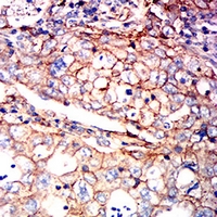 19 - Anti-ATP1A1 Antibody AP95682