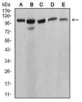 1 - Anti-SERCA1 Antibody AP95683