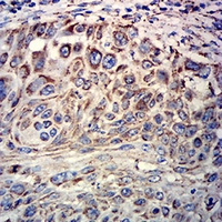 19 - Anti-ATP5A1 Antibody AP95684