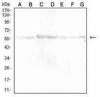 1 - Anti-ATP5A1 Antibody AP95684