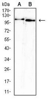 1 - Anti-ATP6AP1 Antibody AP95685