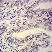 19 - Anti-Ataxin 1 Antibody AP95687