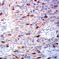 19 - Anti-Aurora A Antibody AP95688