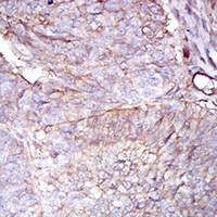 19 - Anti-Beta 2 Microglobulin Antibody AP95689