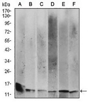 1 - Anti-Beta 2 Microglobulin Antibody AP95689