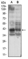 1 - Anti-B3GALT4 Antibody AP95690