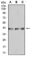 1 - Anti-B3GAT1 Antibody AP95691