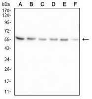 1 - Anti-B4GALNT1 Antibody AP95693