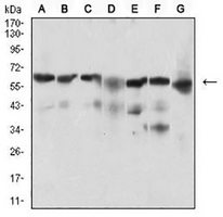 1 - Anti-BACE1 Antibody AP95694