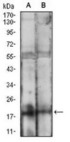 1 - Anti-BAD Antibody AP95695