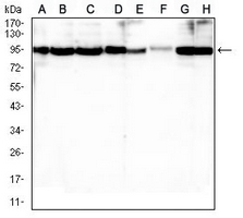 1 - Anti-BCL2 Antibody AP95697