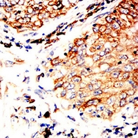 19 - Anti-BCL6 Antibody AP95698