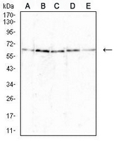 1 - Anti-BCL6 Antibody AP95698