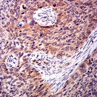 19 - Anti-Amphiphysin 2 Antibody AP95700