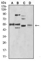 1 - Anti-Amphiphysin 2 Antibody AP95700