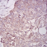 19 - Anti-BMP7 Antibody AP95702