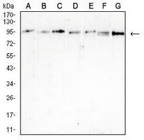 1 - Anti-B-RAF Antibody AP95703