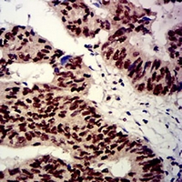 19 - Anti-beta-TrCP Antibody AP95709