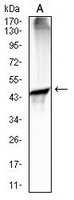1 - Anti-CD88 Antibody AP95710