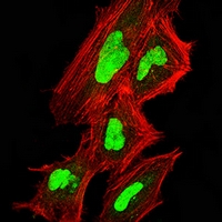 3 - Anti-C9orf72 Antibody AP95712