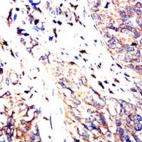 19 - Anti-C9orf72 Antibody AP95712