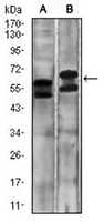 1 - Anti-Carbonic Anhydrase 9 Antibody AP95713