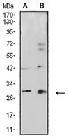 1 - Anti-Calretinin Antibody AP95714