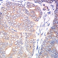 19 - Anti-Calreticulin Antibody AP95715